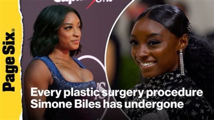 Hannah Simone | Plastic Surgery Before: Ethnicity And Religion