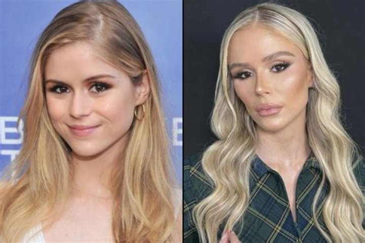 Here Are The Photos Of Kim Lee Before Surgery On Bling Empire, Further Details On The Cosmetic Procedures